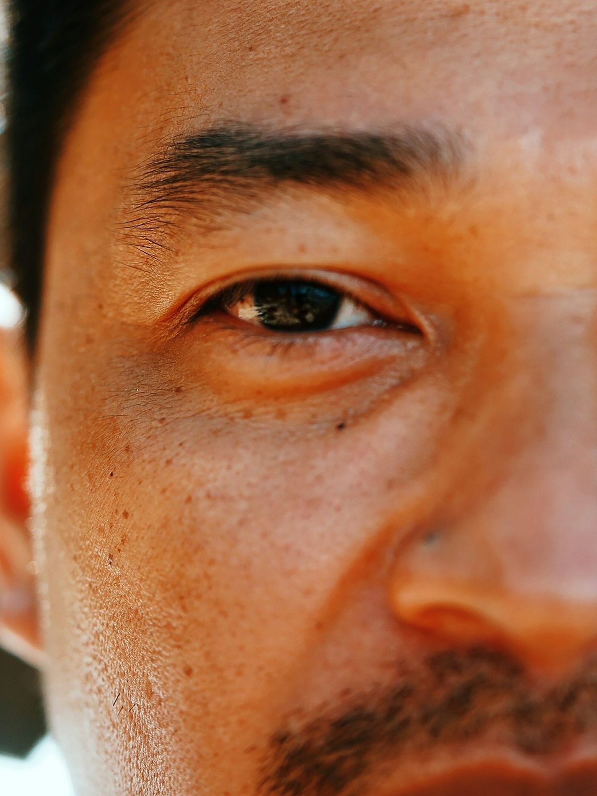 A close portrait of a man's eye, with a hydrogel patch sitting on the bone beneath it